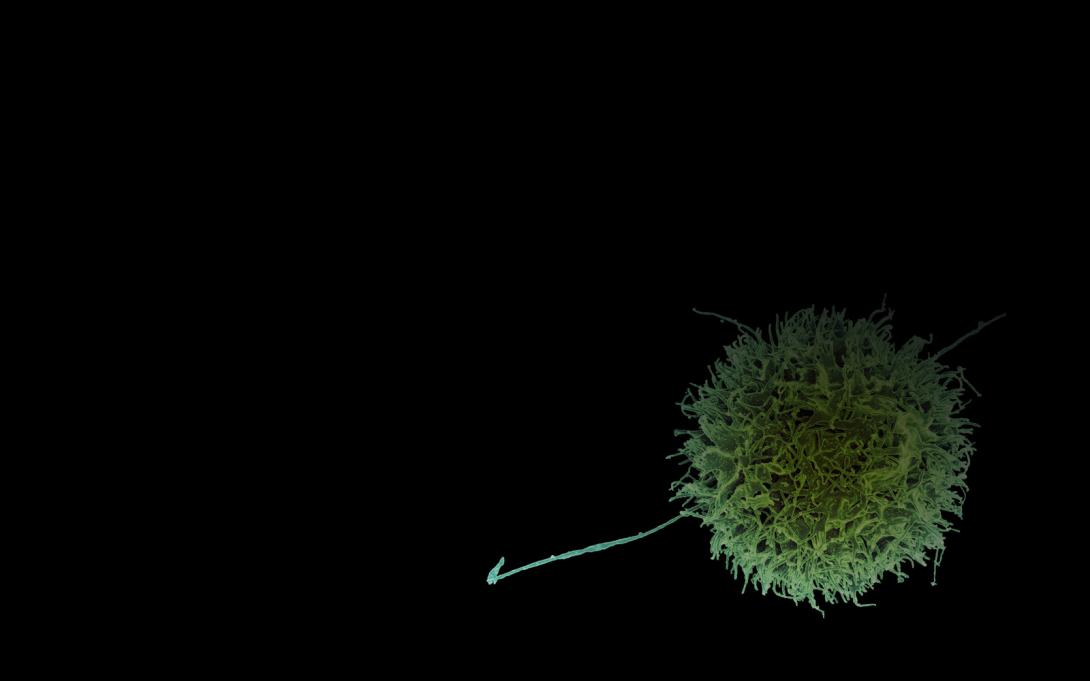 Natural cancer killer cells image